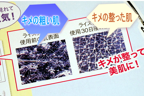 肌のキメ